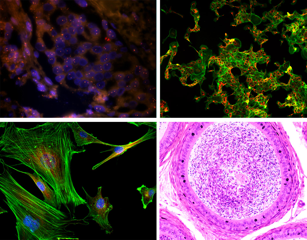 0c1b8c7e1b015ad8c80935e0d8504a62_20200211130305_90609.jpg 0c1b8c7e1b015ad8c80935e0d8504a62_20200211130305_90609.jpg