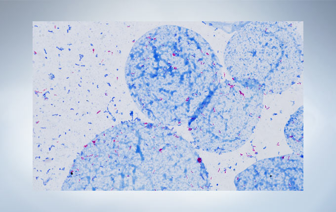 2033c43e201fcaa88bf331aef97e3169_20200213163302_81405.jpg 2033c43e201fcaa88bf331aef97e3169_20200213163302_81405.jpg