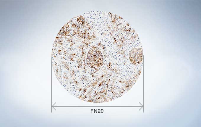 58a96dc2c1531e8d9c23915a1b07c45a_20200213155739_71927.jpg 58a96dc2c1531e8d9c23915a1b07c45a_20200213155739_71927.jpg